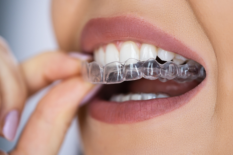 Straighten Your Smile with Clear Aligners in Stansbury Park, UT